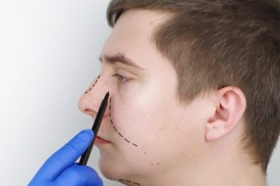 burunrevizyon burunrevizyon